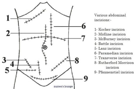 Pin by Cathleen Ha on Wound/Incisions | Medical knowledge, Surgical ...