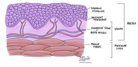 Squamous epithelium | MyPathologyReport.ca