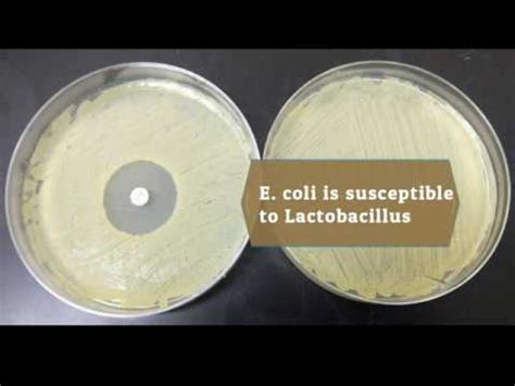 Lactobacillus delbrueckii: characteristics, morphology - science - 2024