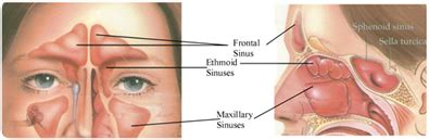 Sinuses Anatomy