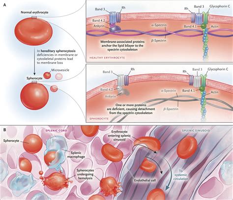 NEJM on Twitter: "New Clinical Problem-Solving: Circling Back for the ...