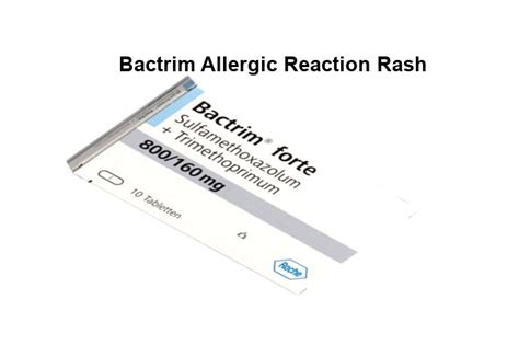 Allergic reaction to bactrim rash, bactrim allergic reactions severe – Pill shop ...