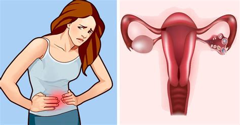 Ovarian cysts: Causes, symptoms, and treatment