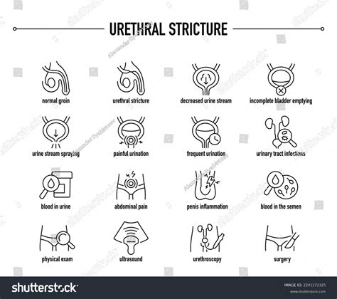 Urethral Stricture Symptoms Diagnostic Treatment Icon Stock Vector (Royalty Free) 2241272325 ...