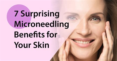 7 Surprising Microneedling Benefits for Your Skin - Camberley Dermapen