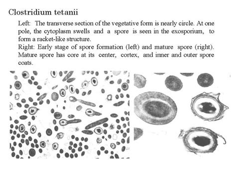 NIAH:NIAH Pathogenic Organisms Observed by Electron Microscope:Clostridium