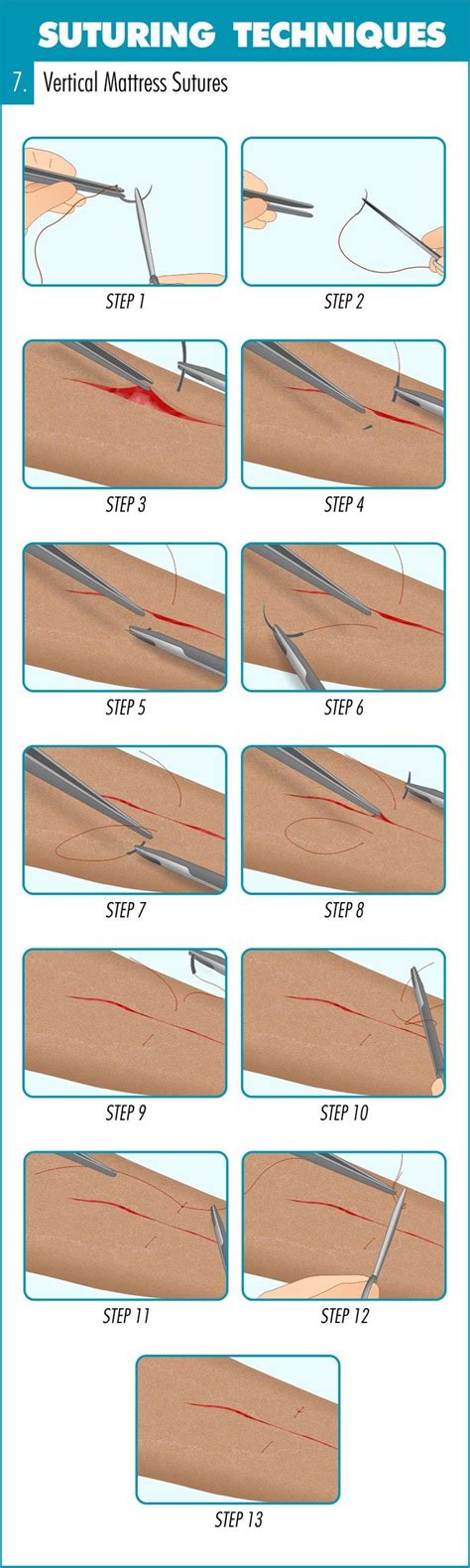 This (infographic) guide runs you through an introduction to suturing ...