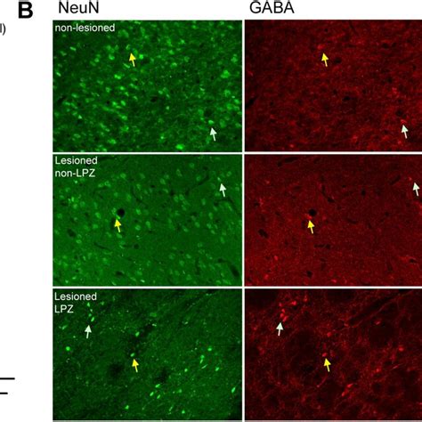 Sampling lateral geniculate nucleus (LGN) for neuronal counting. Right ...