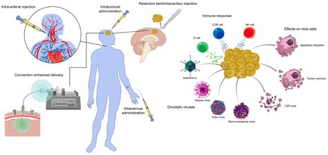 Pharmaceuticals | Free Full-Text | Current Status and Challenges of Oncolytic Virotherapy for ...