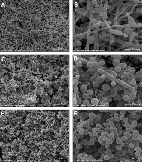 Scanning electron microscopy of the biofilms formed in vitro. A-B ...