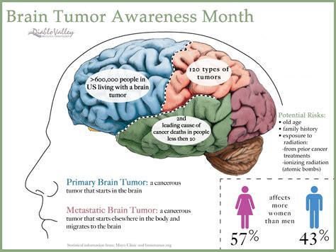 Quotes about Brain tumors (25 quotes)