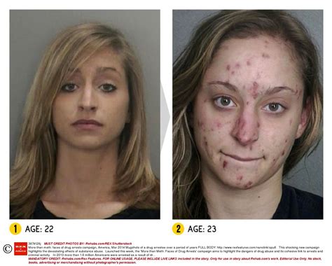 Before and after pics of crystal meth users are enough to put you off for life | Metro News