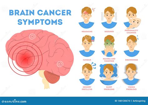 Brain Cancer Anatomy Royalty-Free Illustration | CartoonDealer.com ...