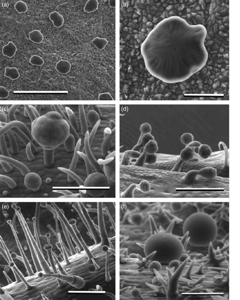 Scanning electron micrographs of diverse eudicot glandular trichomes... | Download Scientific ...