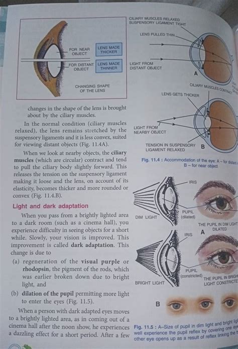 CILIARY MUSCLES RELAXED SUSPENSOAY LIGAMENT TIGHT changes in the shape of..