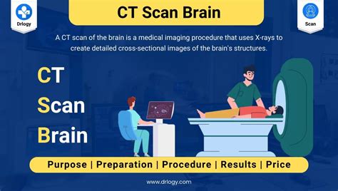 CT Scan of the Brain/Head: Purpose, Procedure, Results & Price - Drlogy