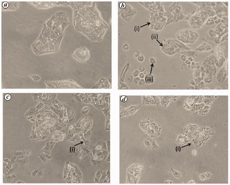 Effect of different treatments on HepG2 cell morphology. a, Normal ...