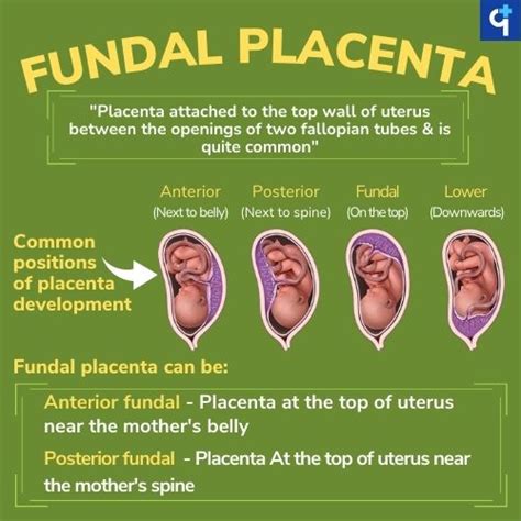 Posterior Fundal Placenta