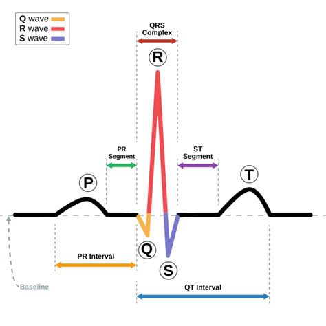 Sinus rhythm - Wikipedia