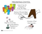 Preventing Cystitis mnemonic notes - PREVENTING CYSTITIS Drink 8 to 10 3455555 of Fluid Per Day ...