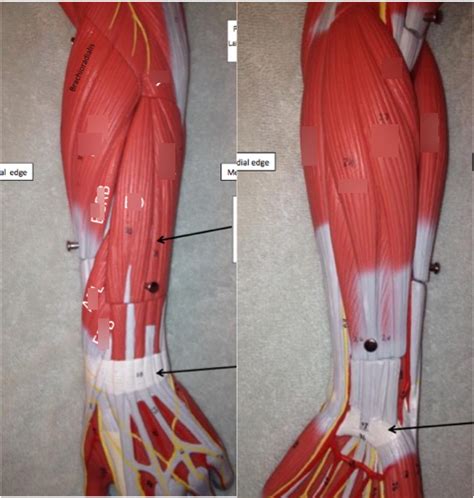 Antebrachial muscles Diagram | Quizlet