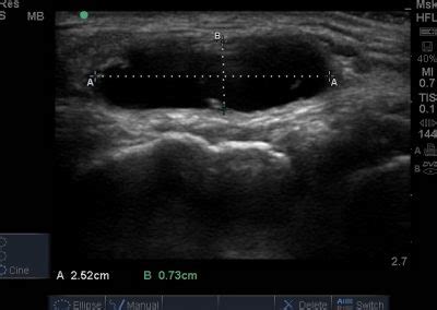 Knee ultrasound – the course of the examination. When to do a knee ...