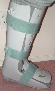 Ankle Splints: Bulky Jones & High-Top Walking Boot | Study.com