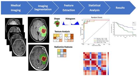 JCM | Free Full-Text | A Multiparametric MRI-Based Radiomics Analysis to Efficiently Classify ...