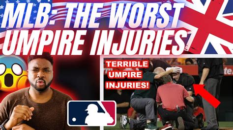 🇬🇧BRIT Reacts To MLB WORST UMPIRE INJURIES! - YouTube