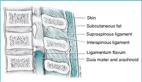 [PDF] Spinal, Epidural, and Caudal Anesthesia: Anatomy, Physiology, and Technique | Semantic Scholar