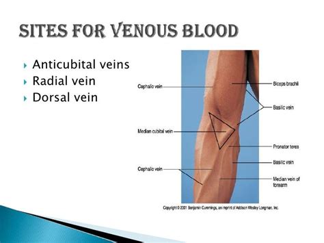 Venipuncture Sites Diagram