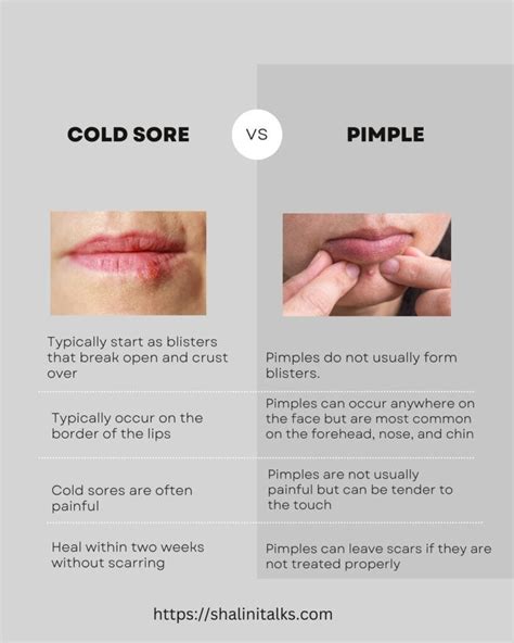 Cold sore vs Pimple on Lips: 4 Absolute Differences and treatment | by ...