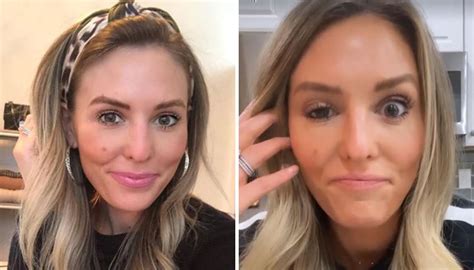 Influencer's eyelid droops after botched Botox treatment | Newshub