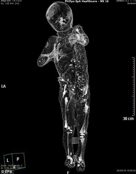 Peering inside Pompeii's victims: Scans reveal unprecedented detail ...