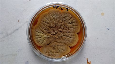 Could anyone tell me colony morphology and characteristics of these fungi pictures?