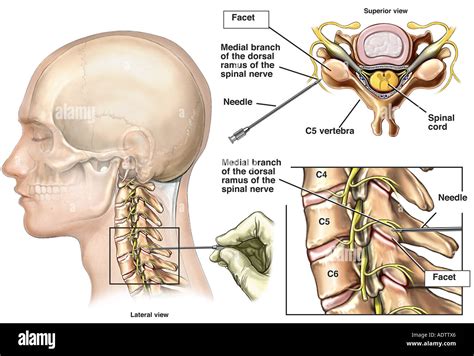 Facet Joint Dorsal Ramus