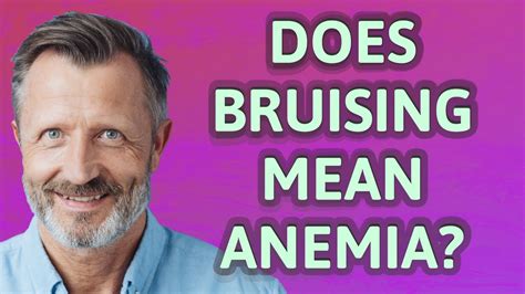 Does bruising mean anemia? - YouTube