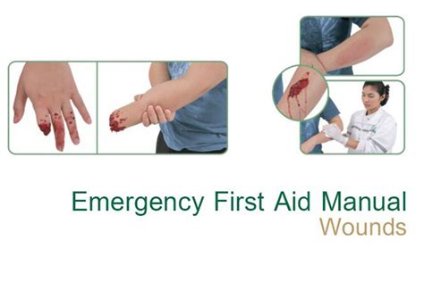 Emergency First Aid Manual – Wounds