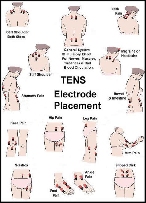 Tens Unit for All Areas of Pain | Health, Student-centered resources ...