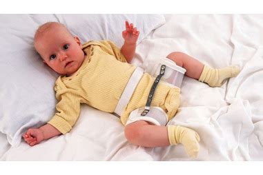 Hip dysplasia in babies | Pregnancy Birth and Baby