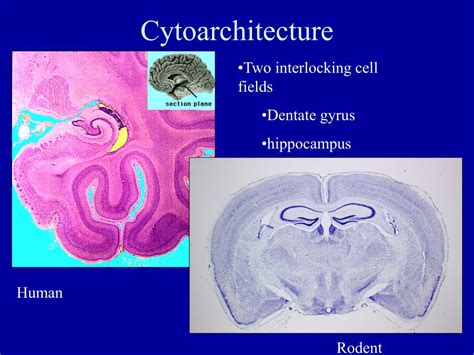 PPT - Olfactory system, Amygdala and Hippocampus PowerPoint ...