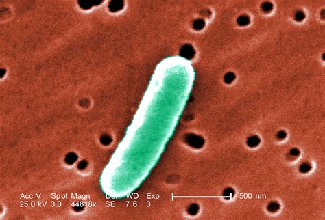 Free picture: morphological details, single, gram, negative, escherichia coli, bacterium