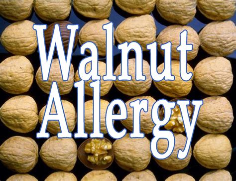 Free Posters and Signs: Walnut Allergy