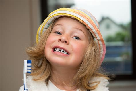 Why It’s Important for Children to Get Braces | Redding CA | Schalo