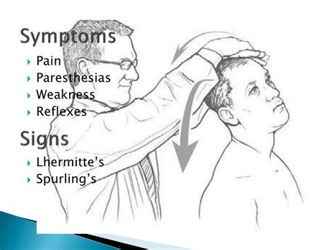 PPT - Cervical Radiculopathy PowerPoint Presentation - ID:4784834