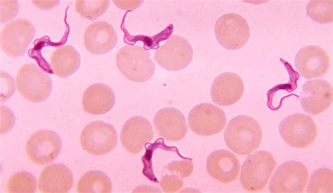 Human African Sleeping Sickness: Biology of Trypanosoma brucei | Owlcation