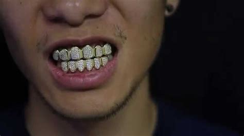 Custom Gold Grillz - 18k Gold Diamond Teeth Grillz - YouTube