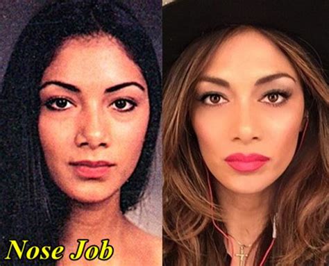 Nicole Scherzinger Plastic Surgery Before And After