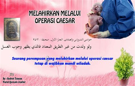 Melahirkan Melalui Operasi Caesar - MWCNU Tarumajaya