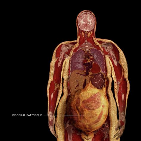 Visceral Fat #2 Photograph by Anatomical Travelogue - Pixels